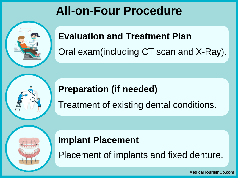 All-on-4 procedure