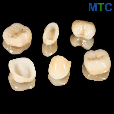 All ceramic crowns