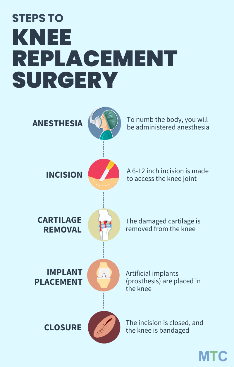 Infographic - Steps to Knee Replacement surgery