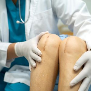 Surgeon examining a patient's knee surgery scars