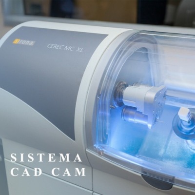 CEREC System for Quick Prosthesis Fabrication