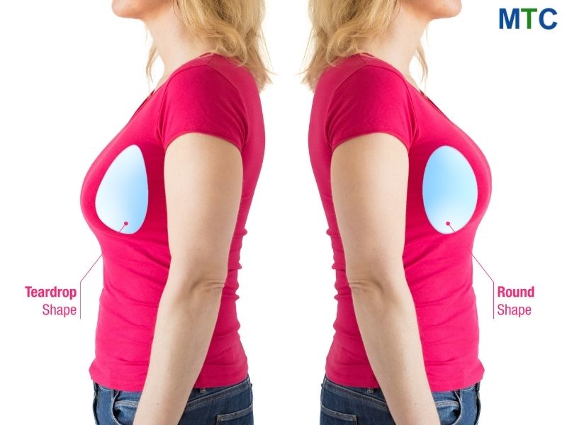 Two woman standing back to back, showcasing round and teardrop implants