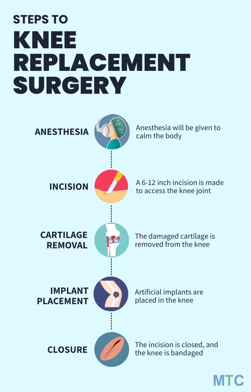 Knee Replacement Procedure in Lithuania