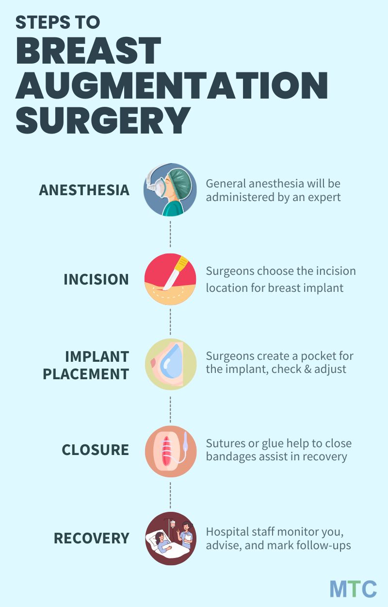 Infographic showing steps to breast augmentation surgery