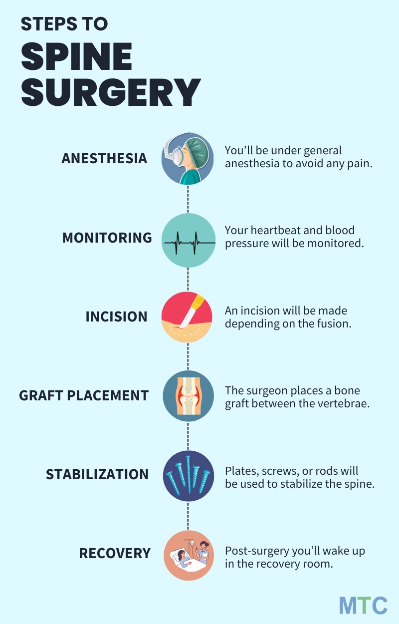 Steps Involved in Spine Surgery