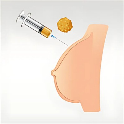 Breast Implants 