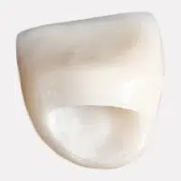 Zirconia Crown