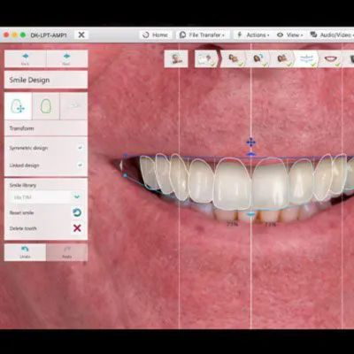 digital smile design