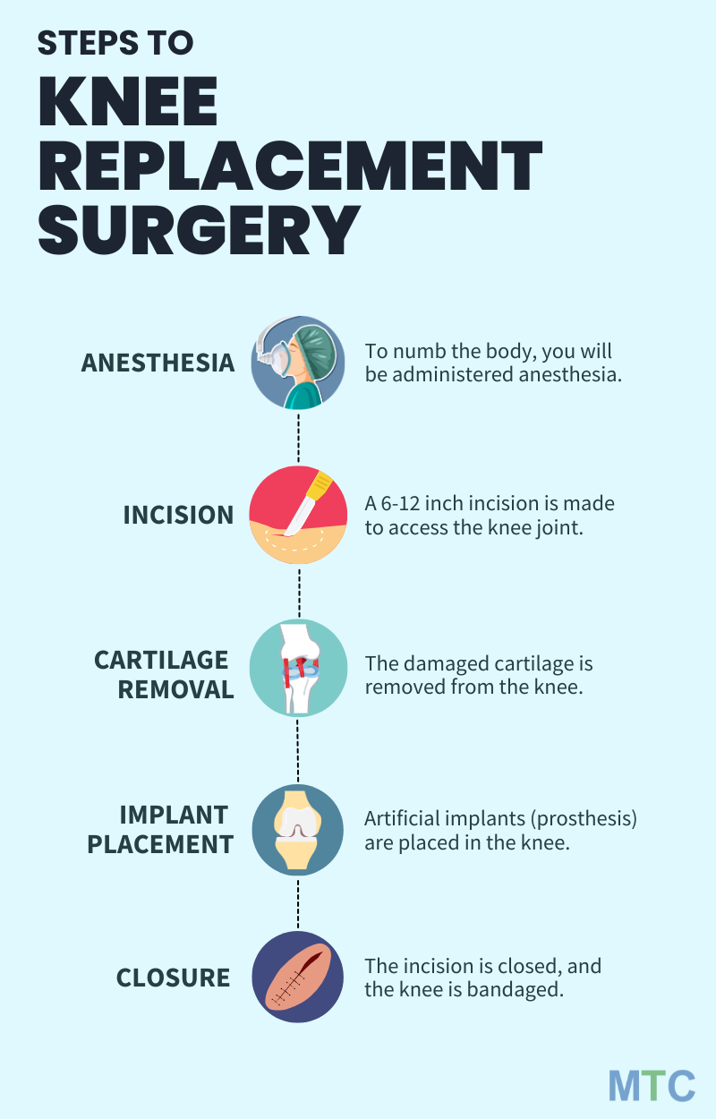 Infographic of knee replacement surgery procedure