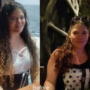 Melonie-Before-Gastric-Bypass-Mexico