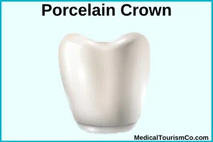 Porcelain Crowns