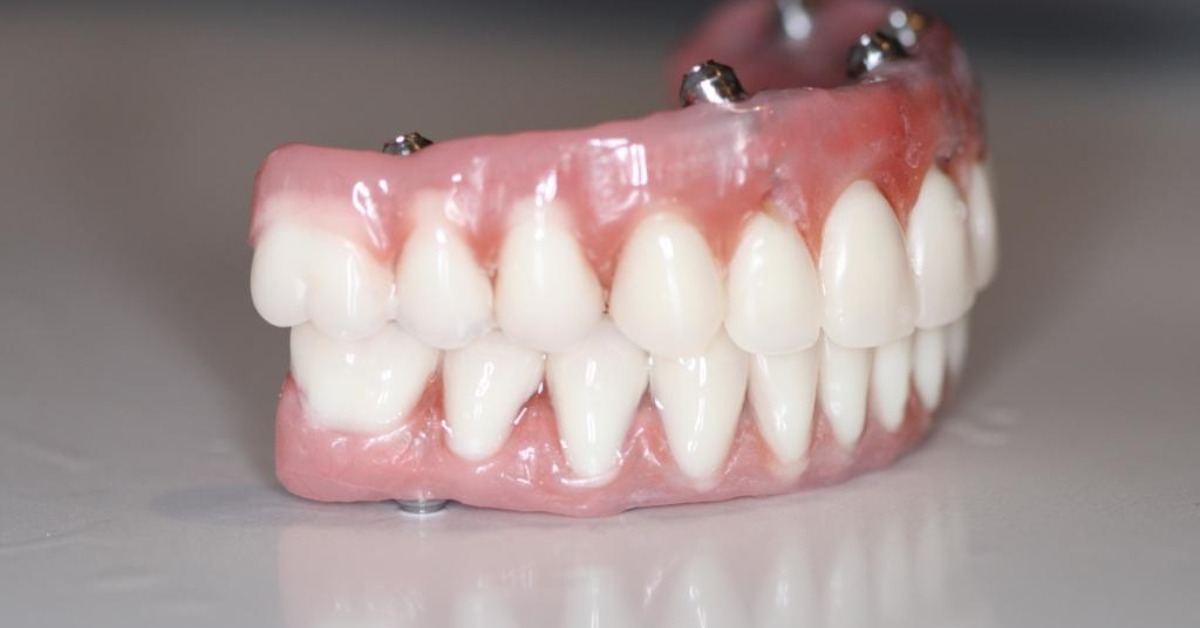 Snap on Dentures in Mexico