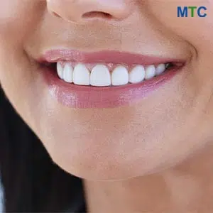 Teeth Whitening