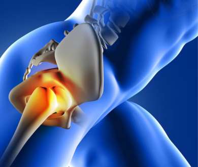 Hip replacement packages