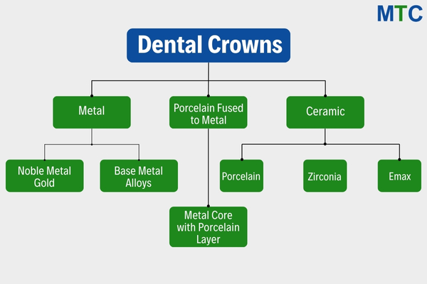 Types of Dental Crowns