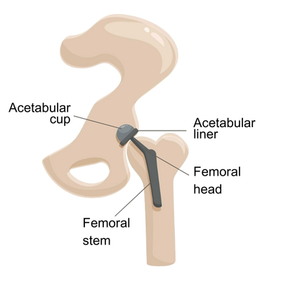 Anatomy of a Hip Joint