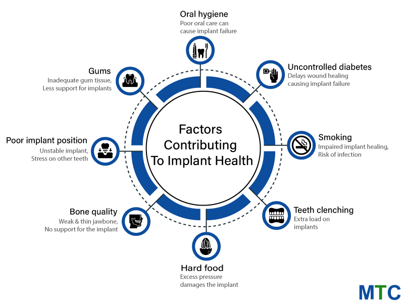 Factors Contributing To Implant Health