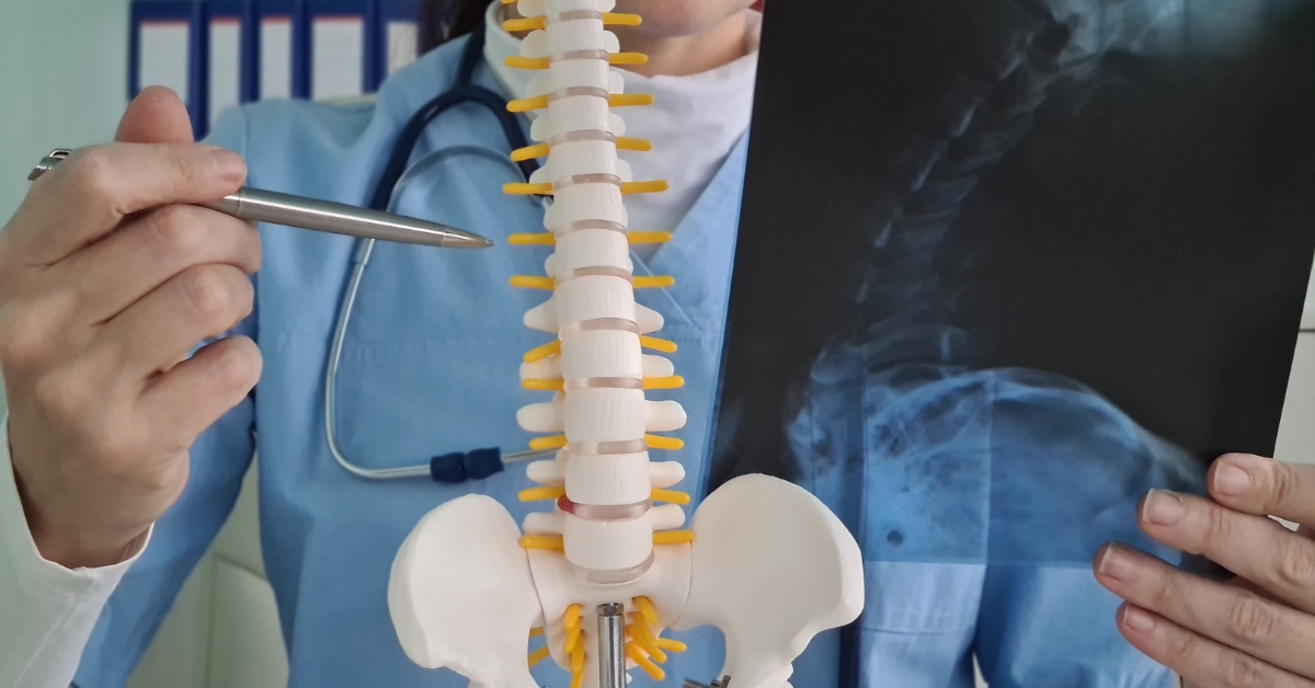 Lumbar Discectomy in New Delhi India