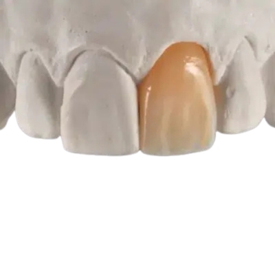 KATANA Zirconia YML