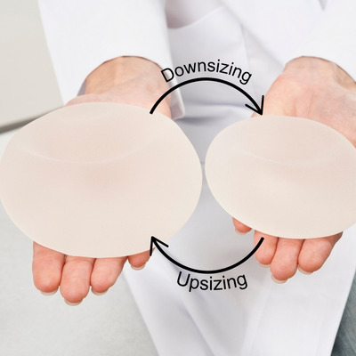 Doctor holding two different-sized breast implants illustrating the concept of adjusting implant size for breast revision