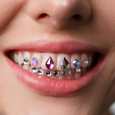 Dental jewellery