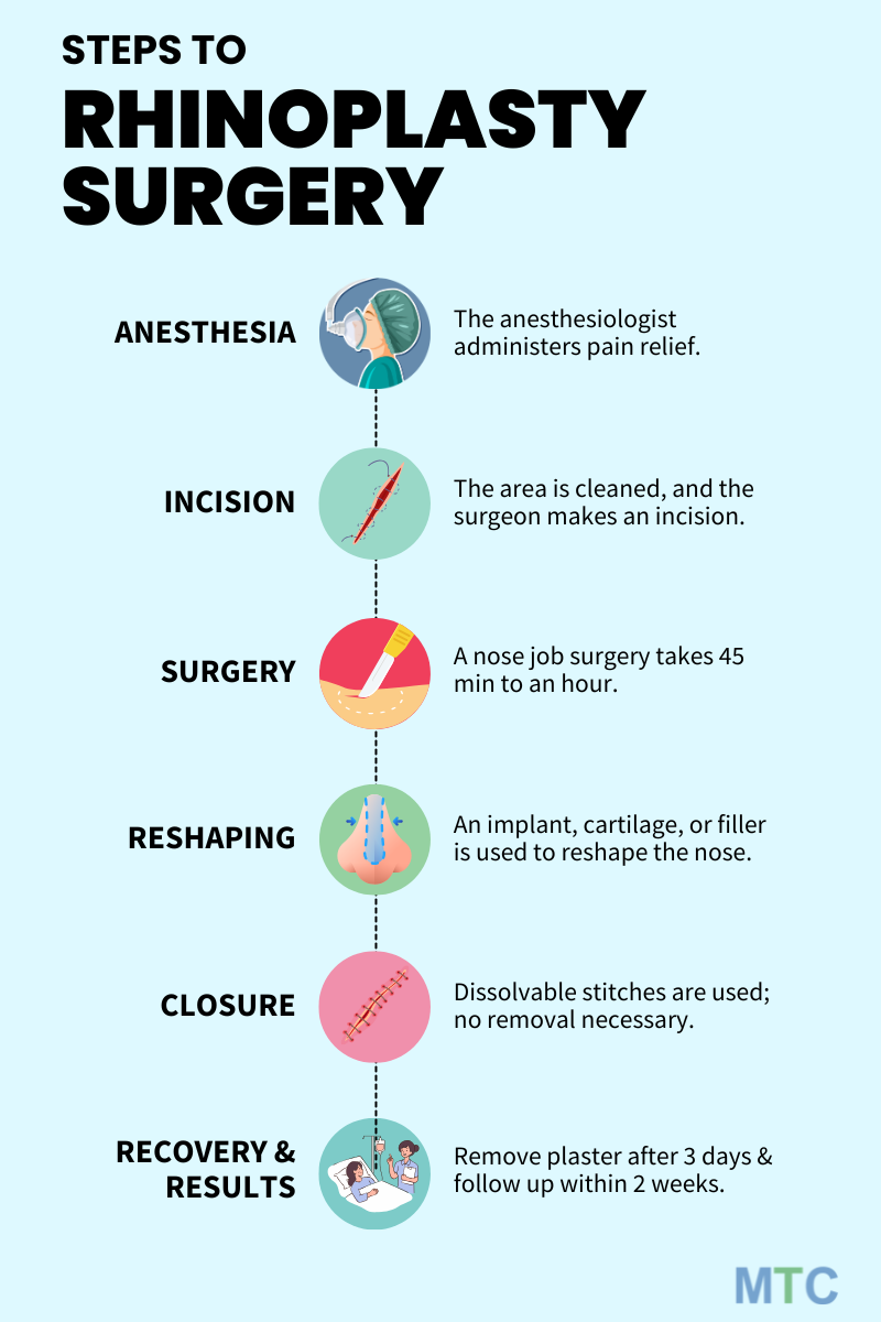 Rhinoplasty surgery procedure