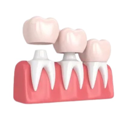 Dental crowns