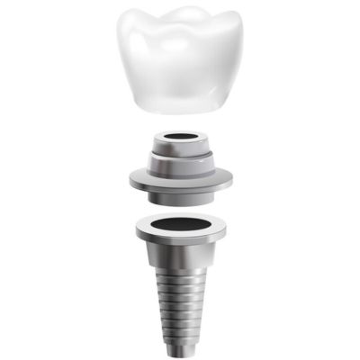 Parts of dental implant