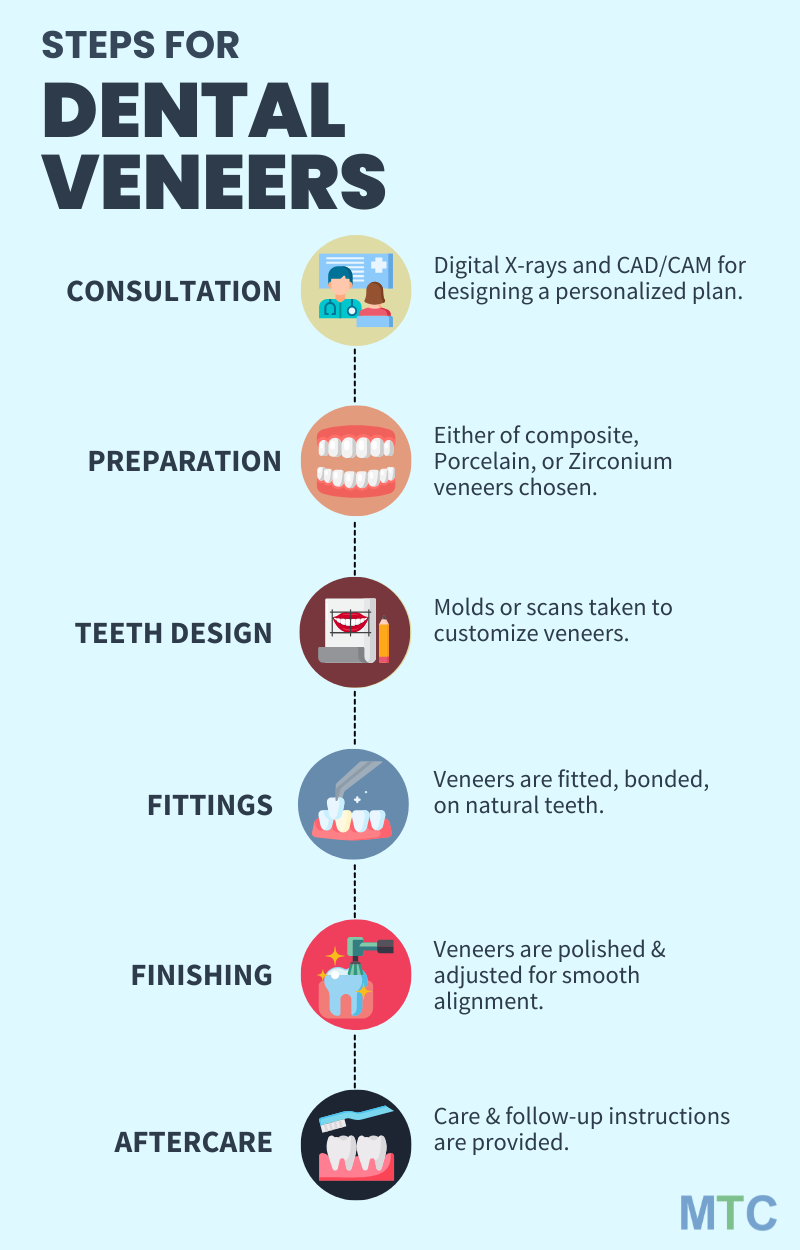 All about Dental Veneers Procedure