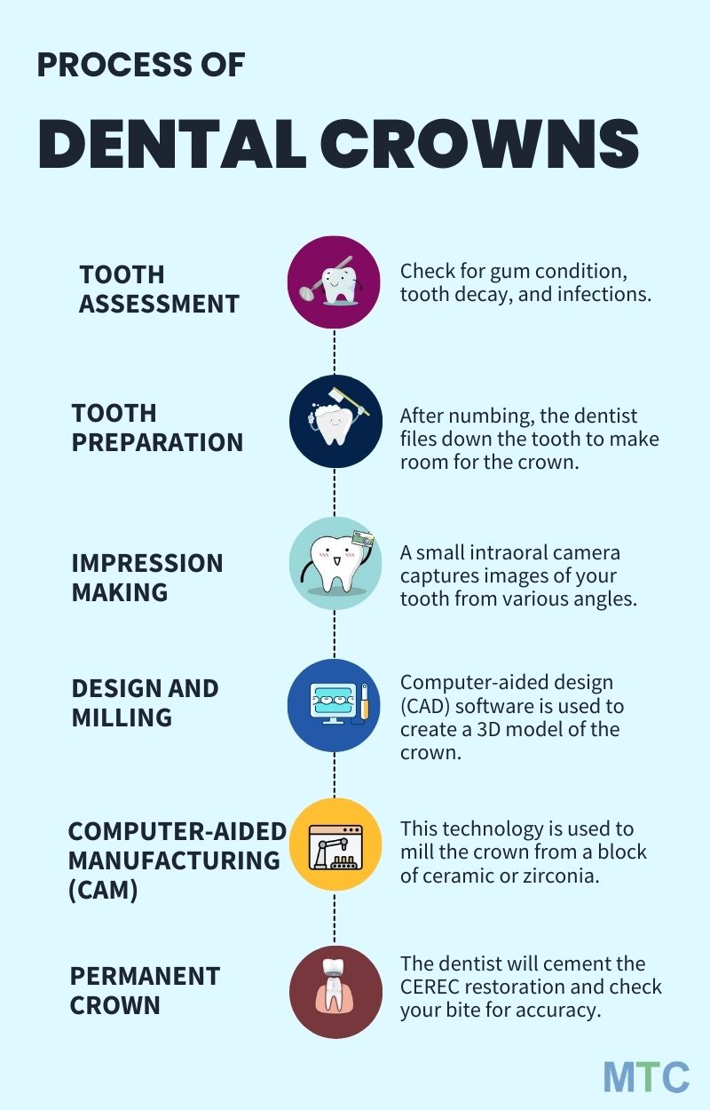 Process of Getting Dental Crowns in Phuket