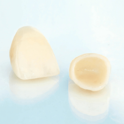 Ceramic Crowns