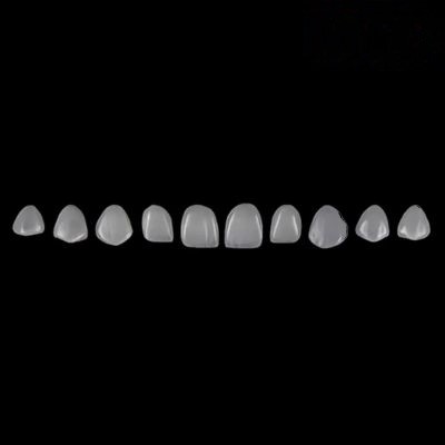 e max veneers