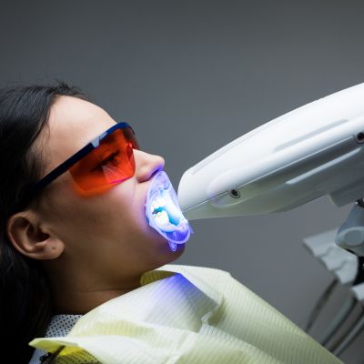 laser assisted teeth whitening procedure of a woman