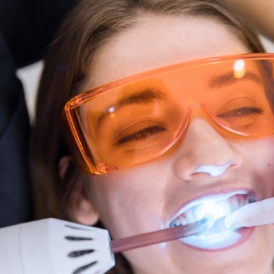 Teeth whitening