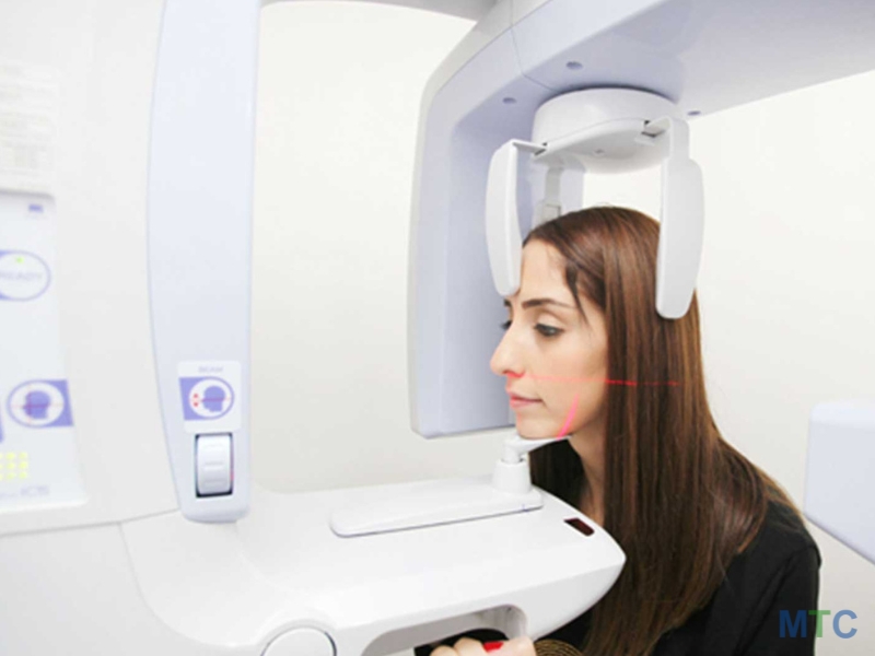 CBCT Technology