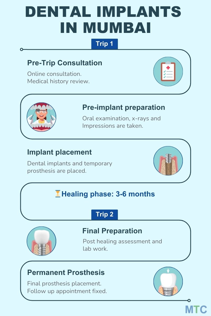 Procedure of Dental Implants In Mumbai