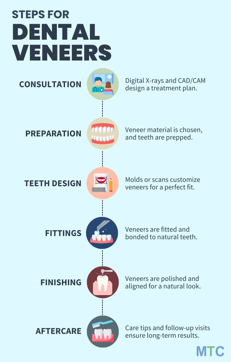 Dental Veneers