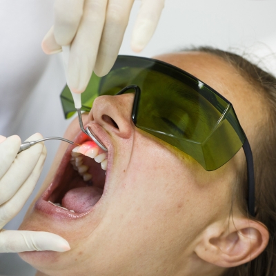 State-of-the-Art Dental Laser in Delhi Clinics for Detecting Dental Problems