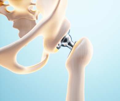 Hip Replacement Surgery