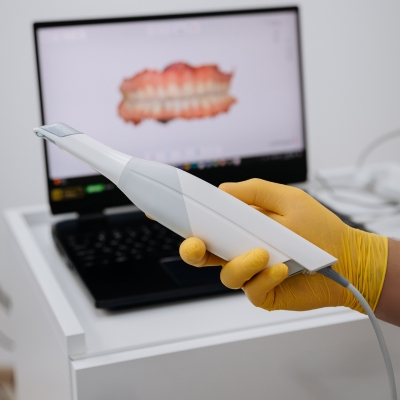 Intraoral Scanner