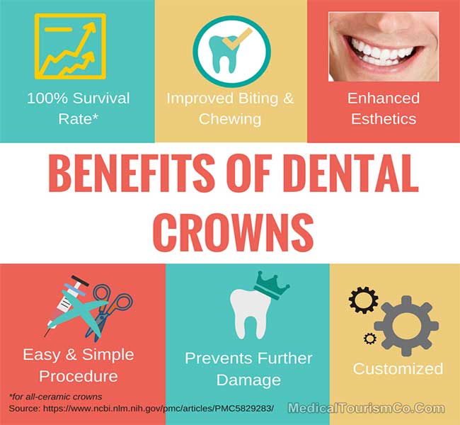 Benefits of Dental Crowns