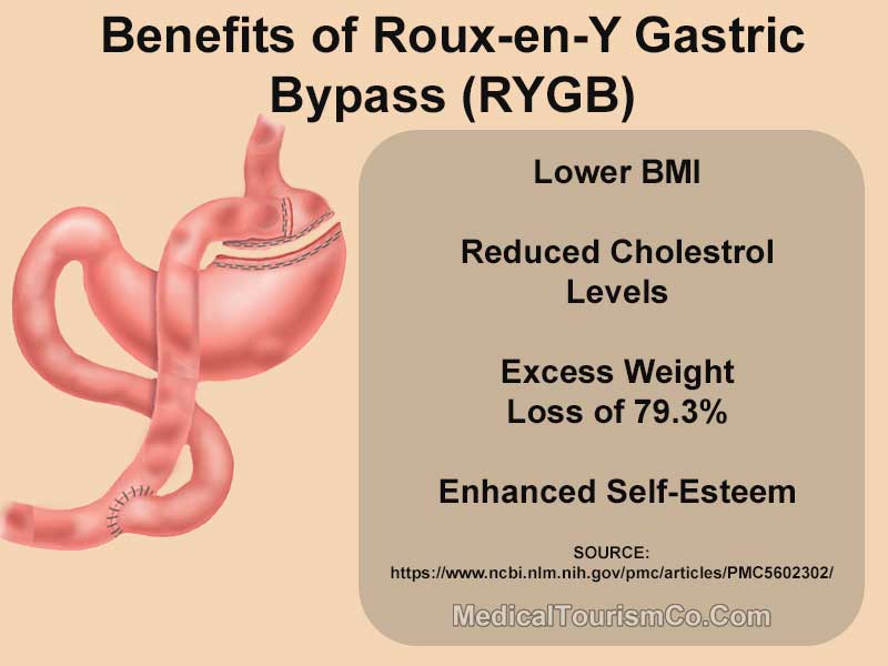 Benefits of RYGB