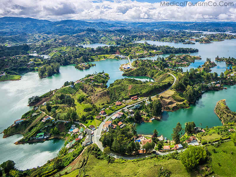 Dental tourism in Medellin- Guatape & El Peño