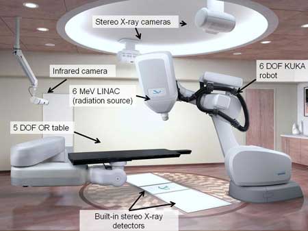 Cyber Knife Surgery in India