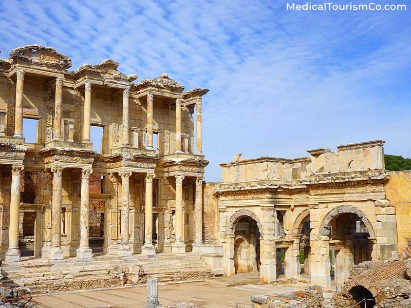 Ephesus Archaeological Museum | Dental Tourism in Turkey
