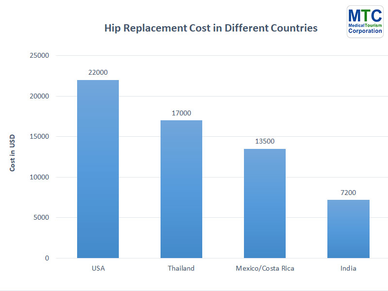 Hip Replacement Cost | Different Countries