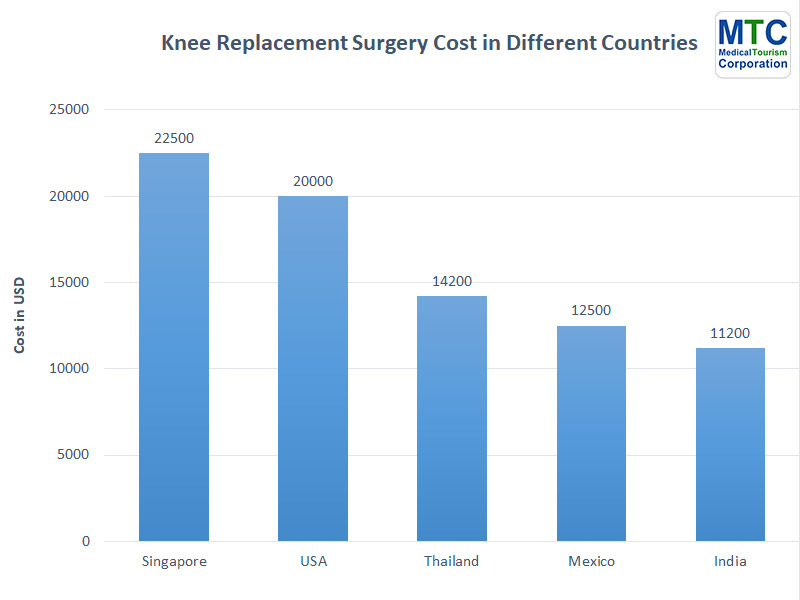 TKR Cost | Different Countries