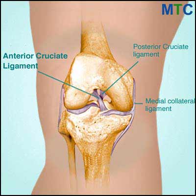 ACL Reconstruction