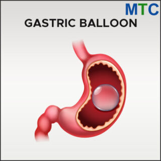 Gastric Balloon in Las Vegas