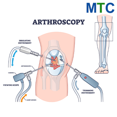 Knee Arthroscopy in Lithuania